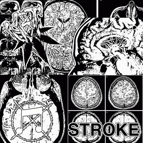 Vaginal Bear Trap : Stroke